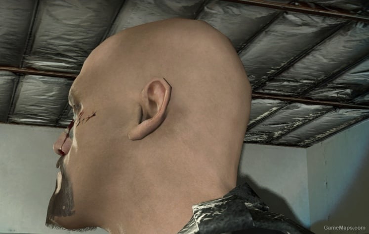 francis head bald injured v2