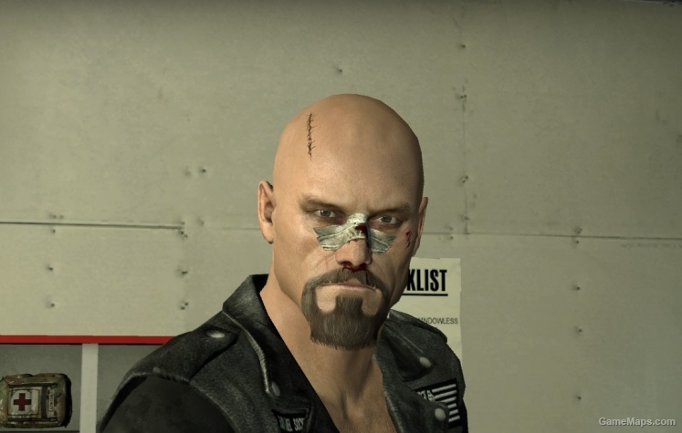 francis head bald injured v2