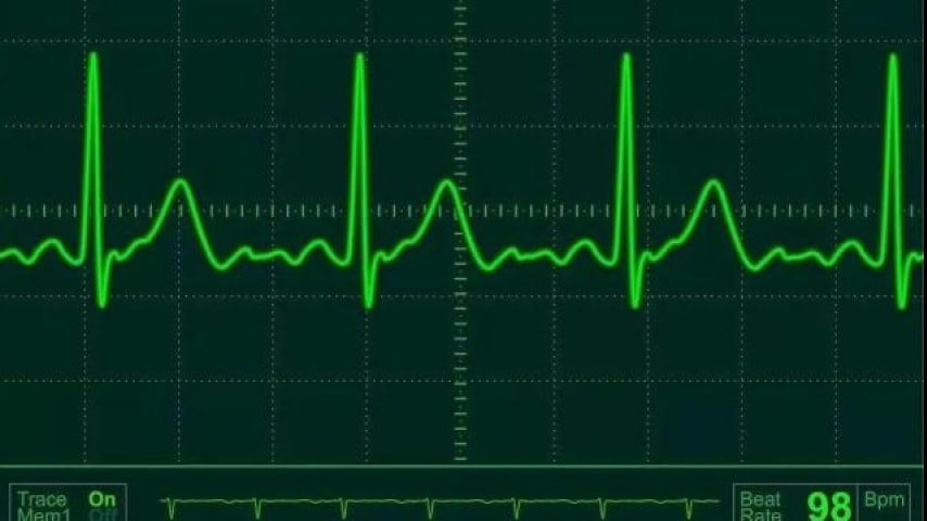 ECG Dynamic HeatlhBar ECG Dynamic HeatlhBar