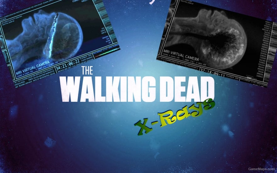 TWD X-Rays (animated/RNG)