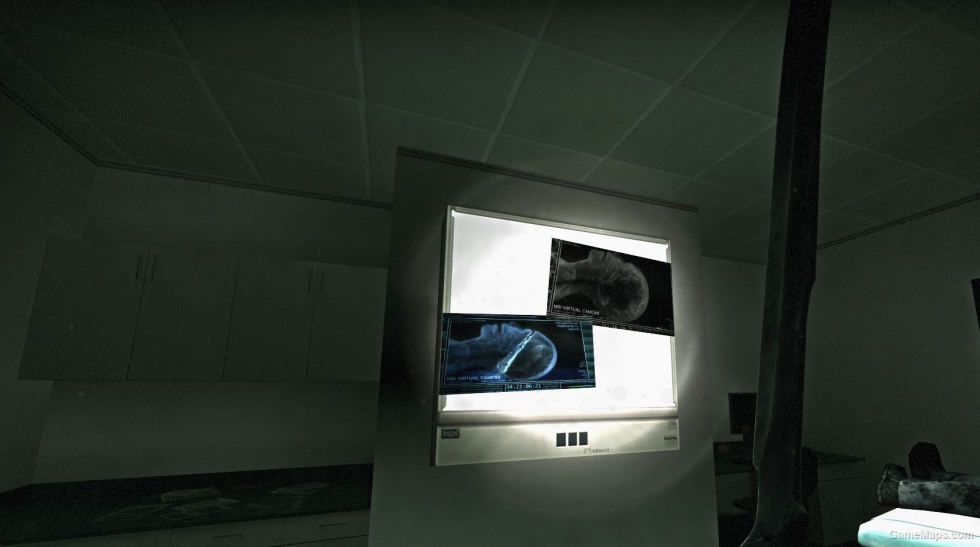 TWD X-Rays (animated/RNG)