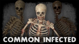 Skeletons (Guts Free)