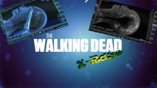 TWD X-Rays (animated/RNG)